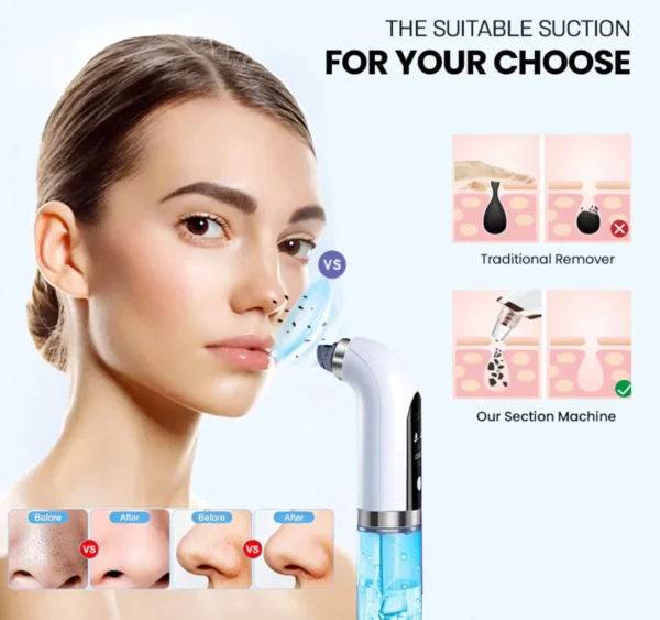 Bubble Facial & Blackhead Remover – Deep Cleanser for Acne, Pores & Glowing Skin | Pimple & Oil Control tool | Blemish-Fighting & Matte Finish | Bubble Technology Pore Purifier  - Image 18
