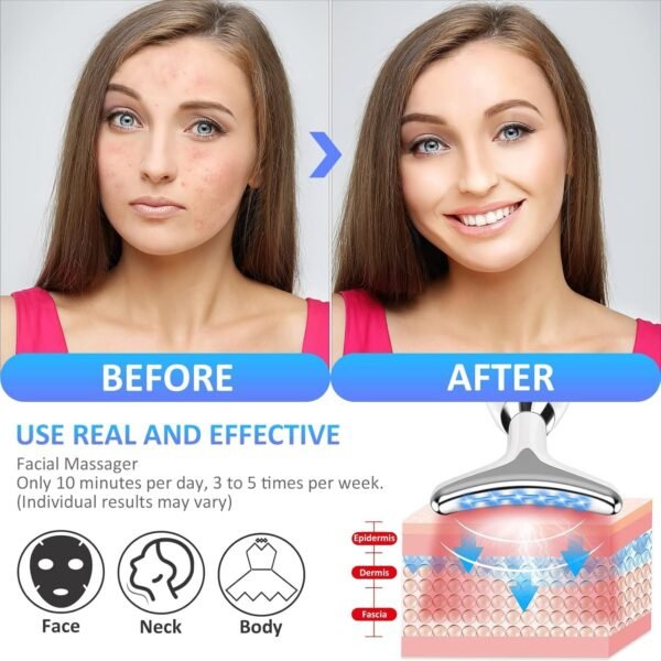 ES-1081 Massager Intense Pulsed Light Wrinkles Reducing Instrument - ESX - Anti Ageing & Reduces Puffiness | Face Massager For Fine Line & Wrinkles - Random Color  - Image 5